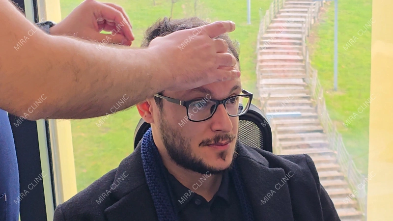 Previous Hair Transplant Experience
